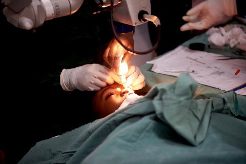 Eye surgery